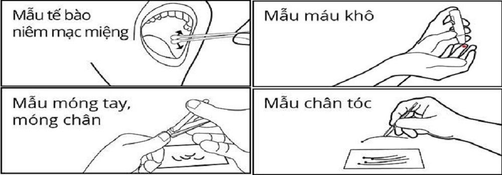 Bảng giá xét nghiệm chuẩn đoán trước sinh QF PCR, Bảng giá xét nghiệm chuẩn đoán trước sinh QF PCR